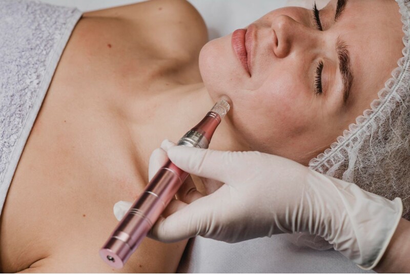 Microneedling MilaCosmetology
