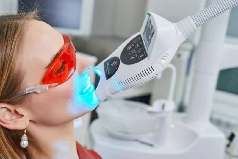 Максимальное фотоотбеливание в Smile Lab в Таллине