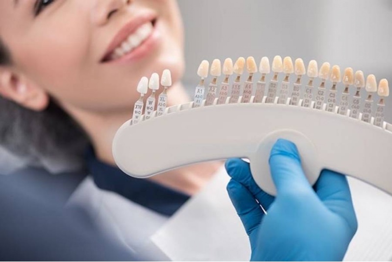 Максимальное фотоотбеливание Smile Lab в Таллине