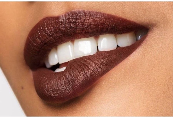 Глубокое фотоотбеливание Smile Lab в Таллинне
