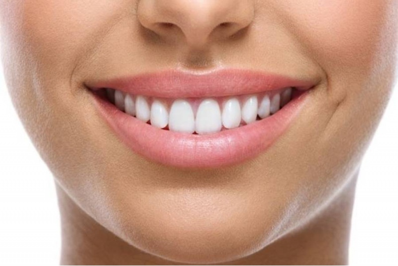 Экспресс-фотоотбеливание в Smile Lab в Таллинне