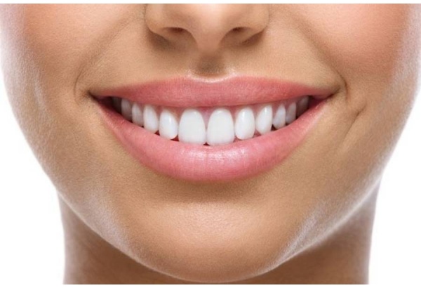 Экспресс-фотоотбеливание Smile Lab в Таллине